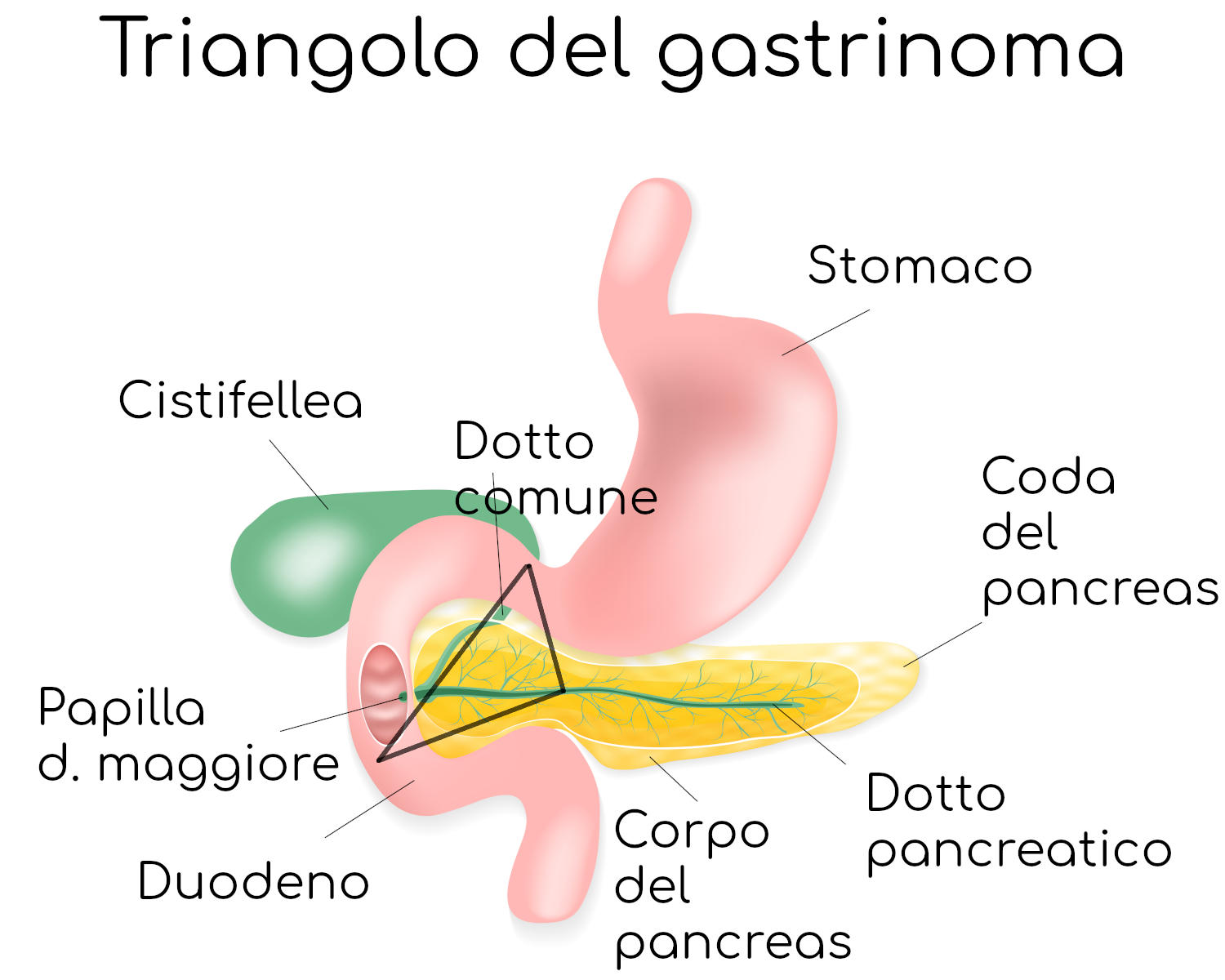 Triangolo del gastrinoma