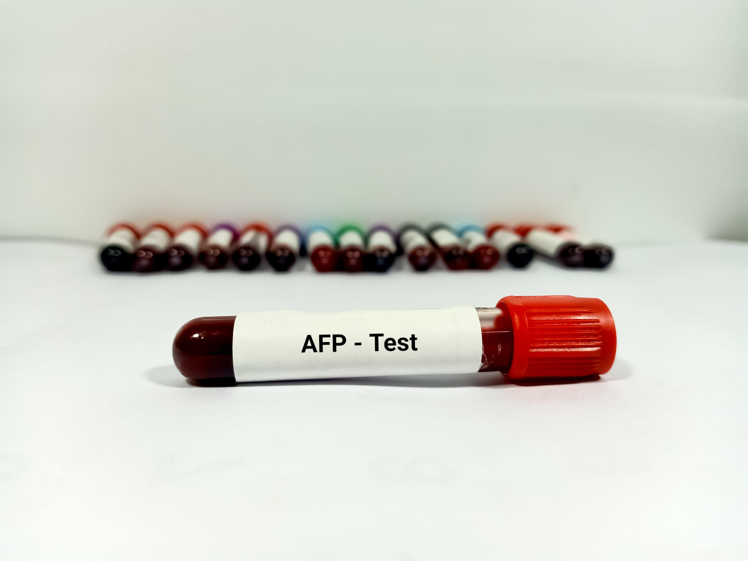 Provetta di sangue per l'analisi della alfa-fetoproteina