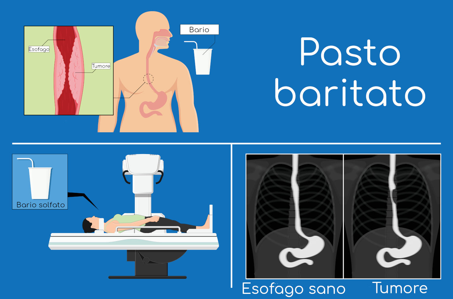 Pasto baritato