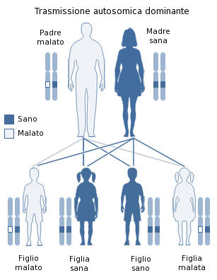 Trasmissione autosomica dominante