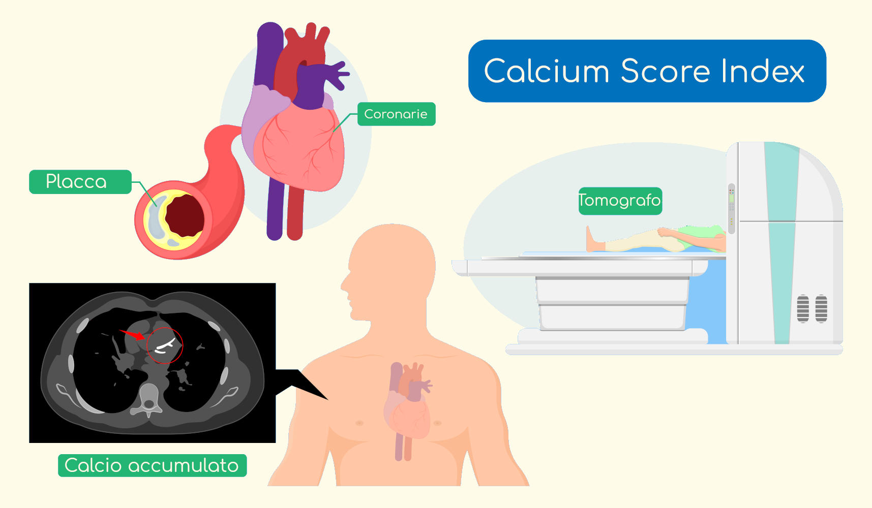 Calcium score index