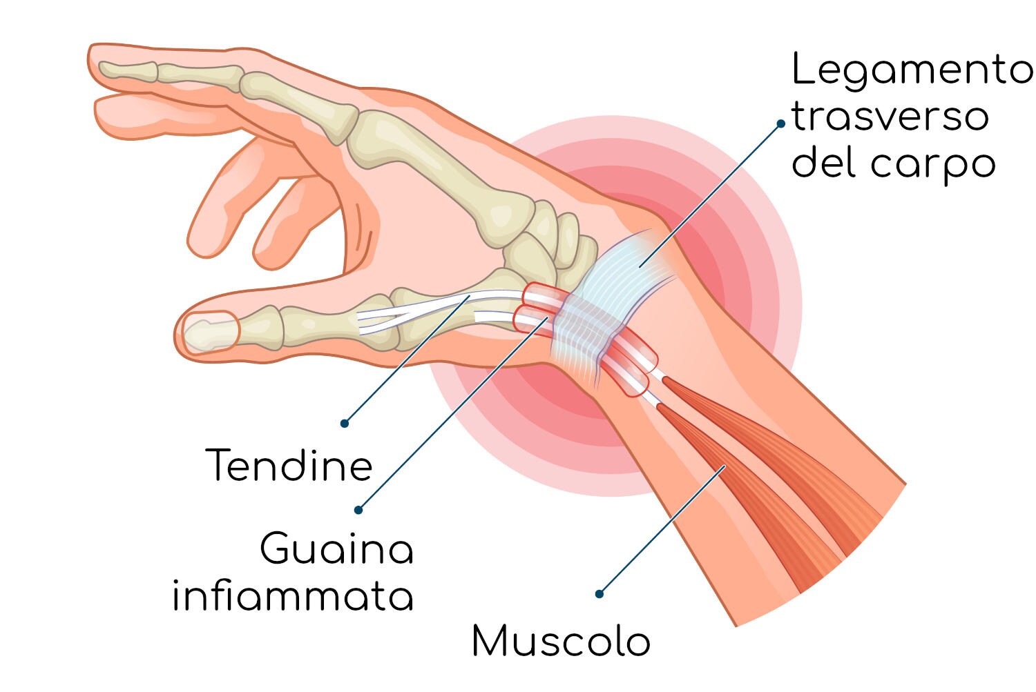 Anatomia del tendine