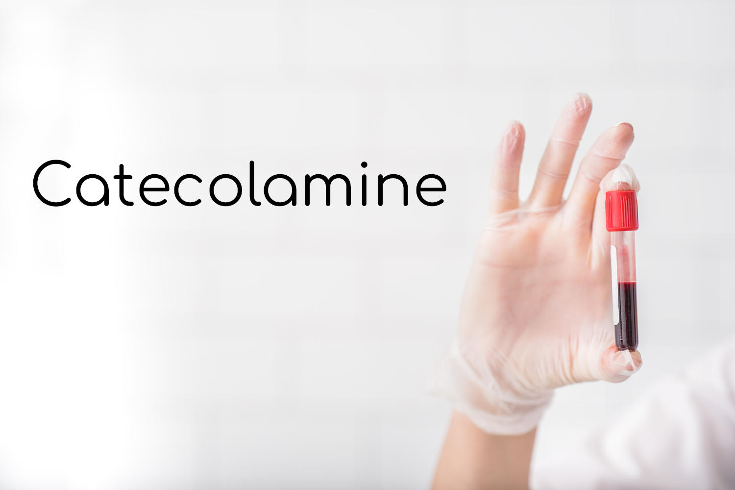 Mano che tiene in mano una provetta di sangue e fianco la scritta catecolamine