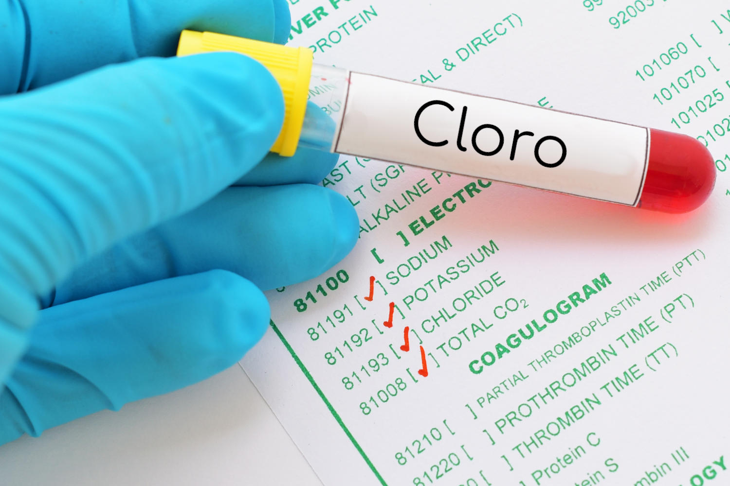 Cloro nel sangue