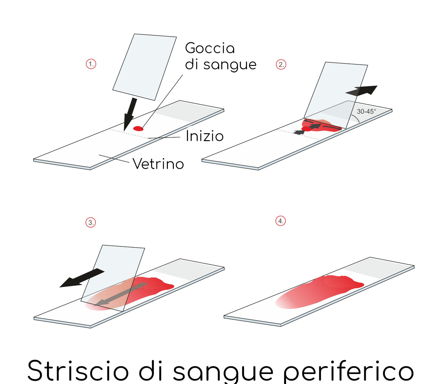Striscio di sangue periferico, preparazione del campione
