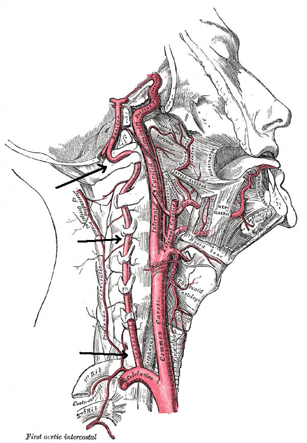 Arteria vertebrale