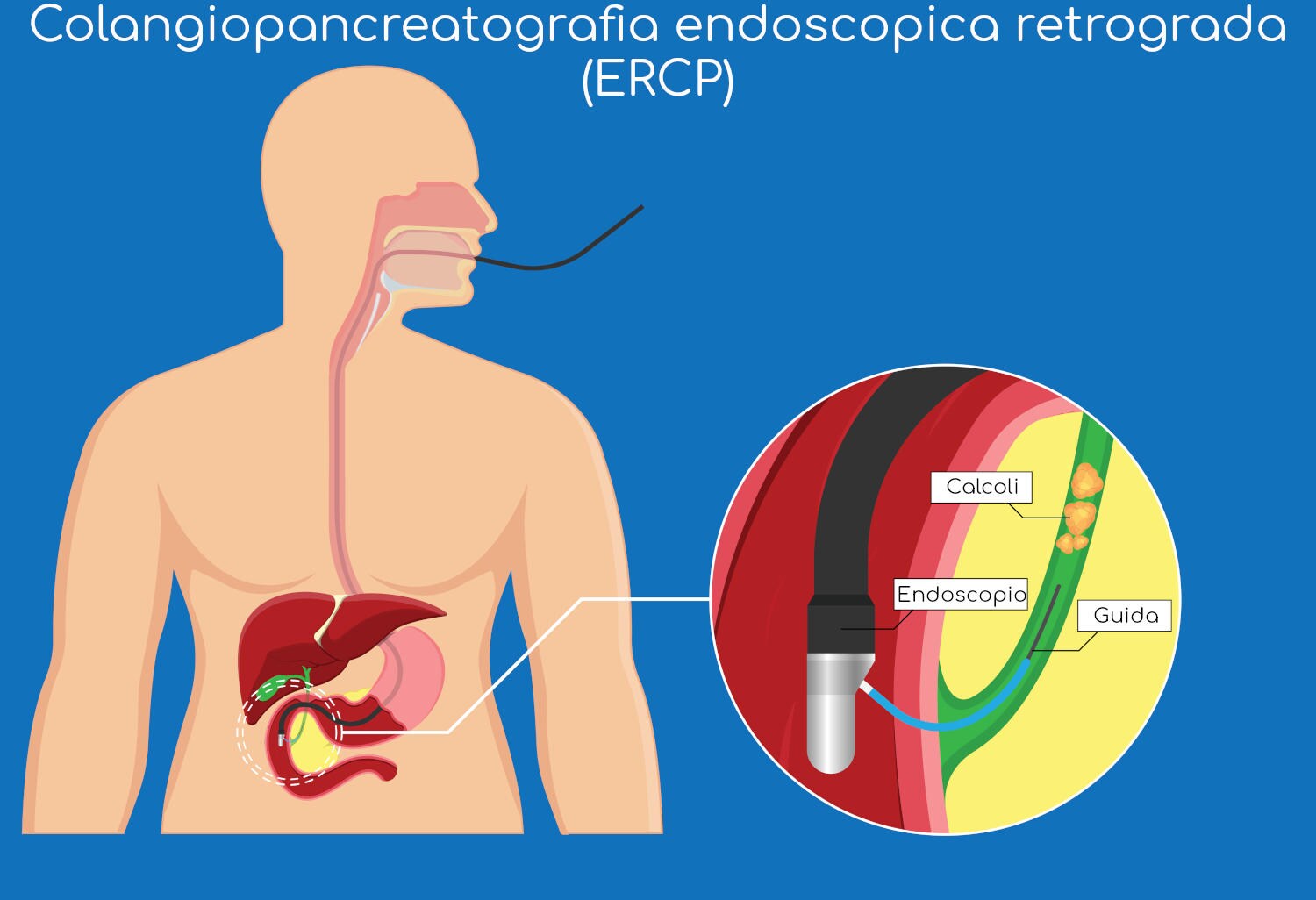 Esame ERCP