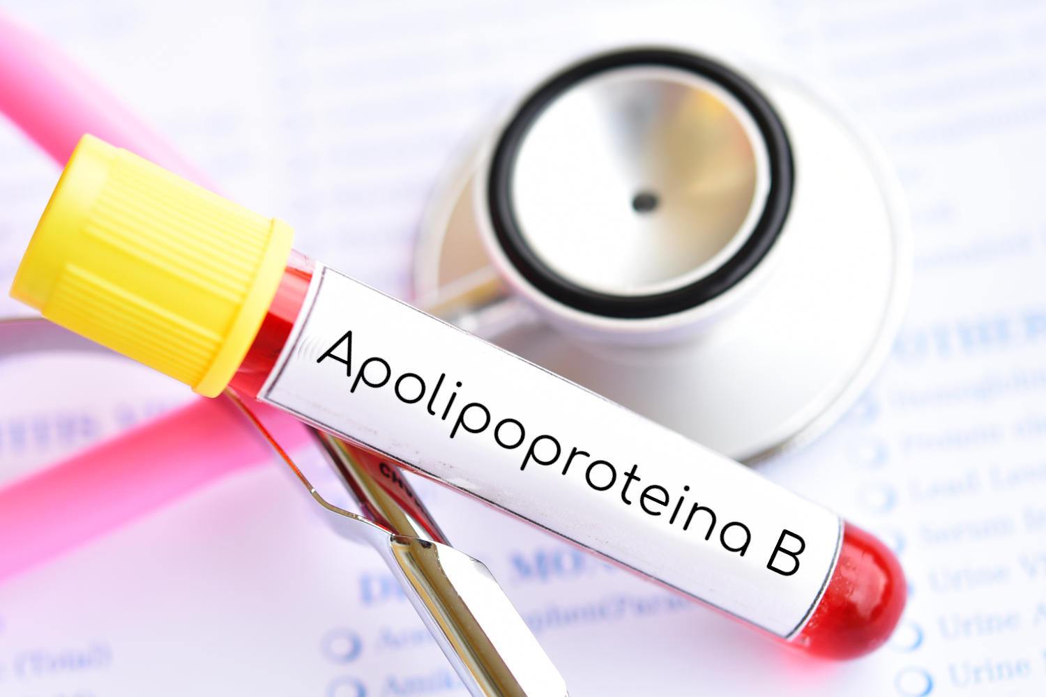 Provetta di sangue con la scritta Apolipoproteina B