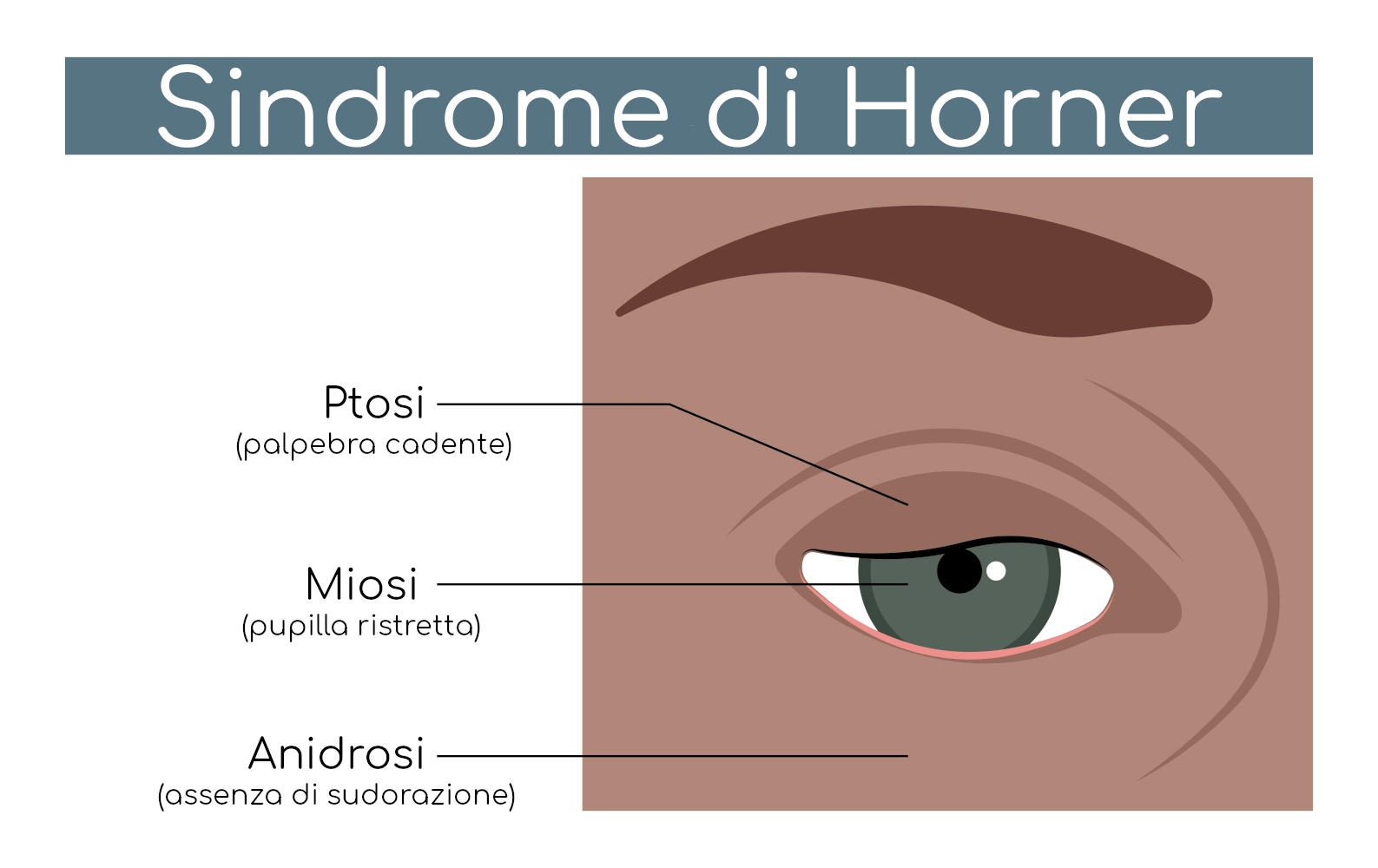 Rappresentazione grafica della triade di Horner