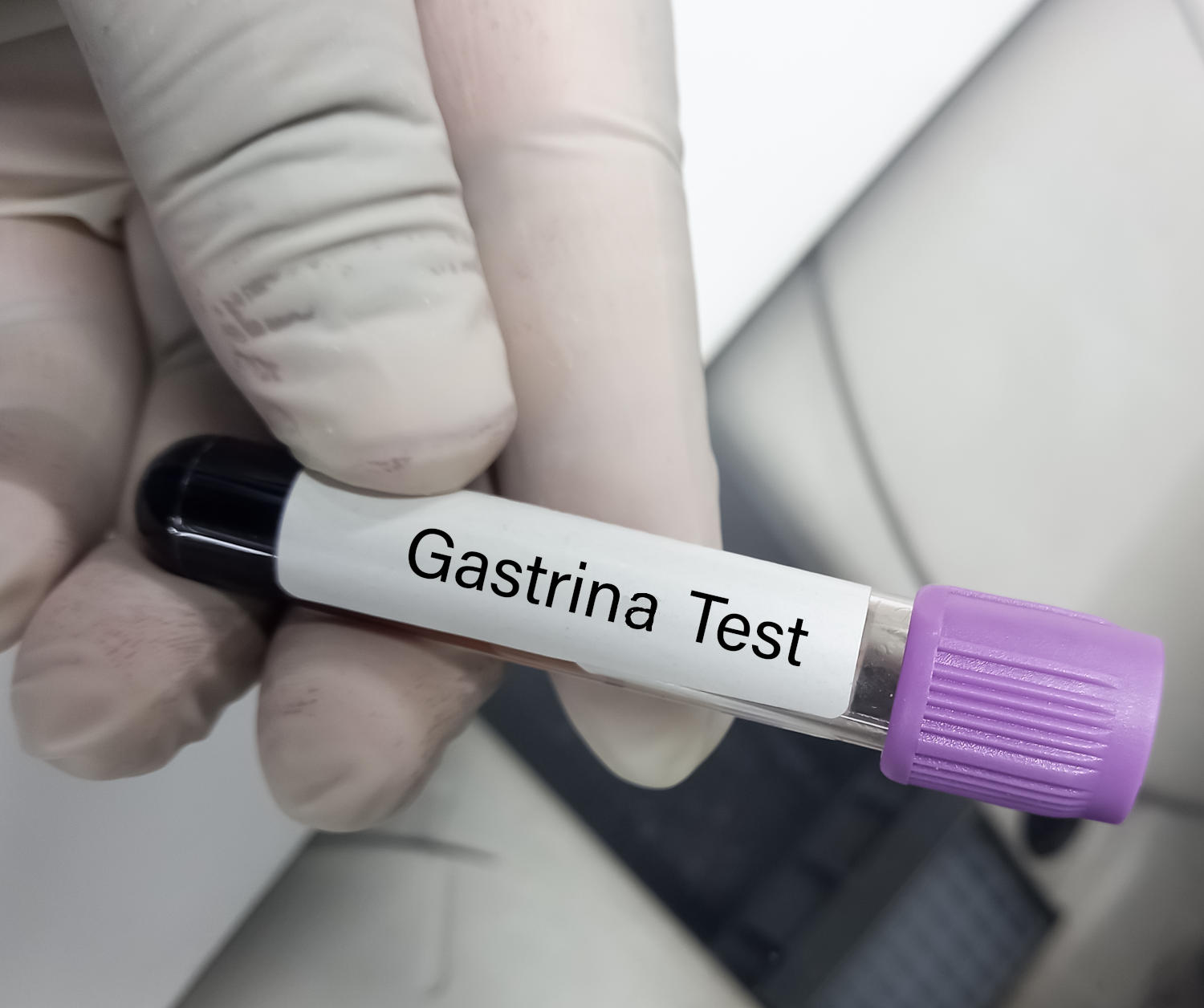 Provetta di sangue con la scritta "Gatrina test"