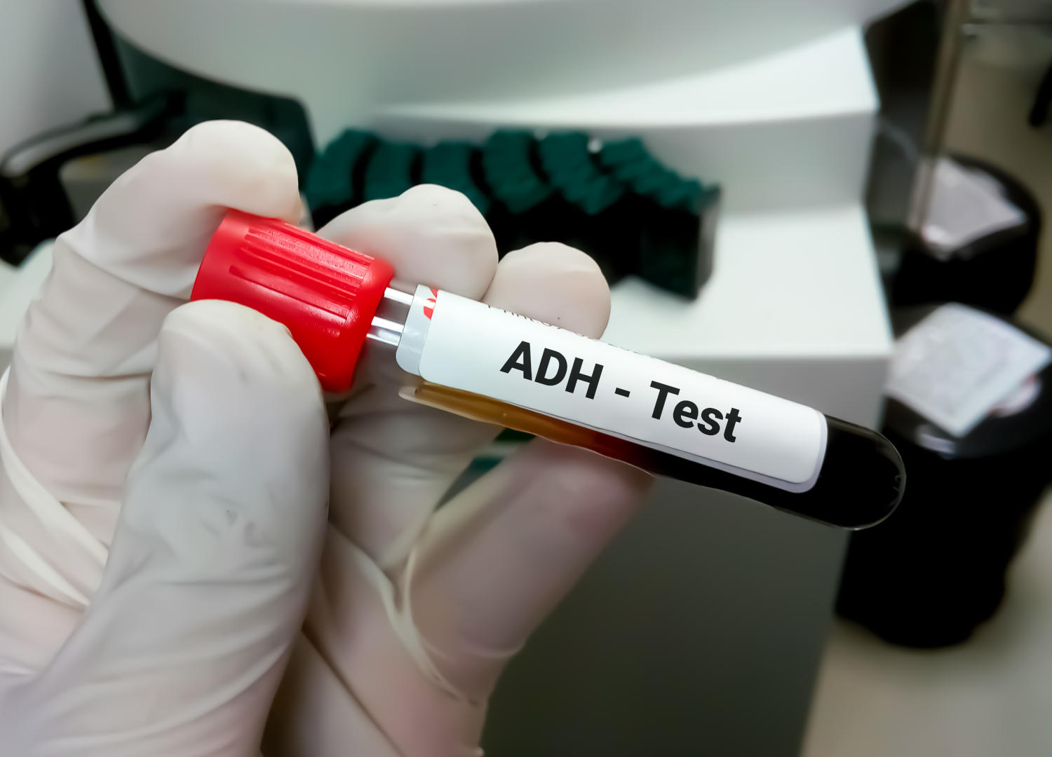 Provetta di sangue con la scritta ADH