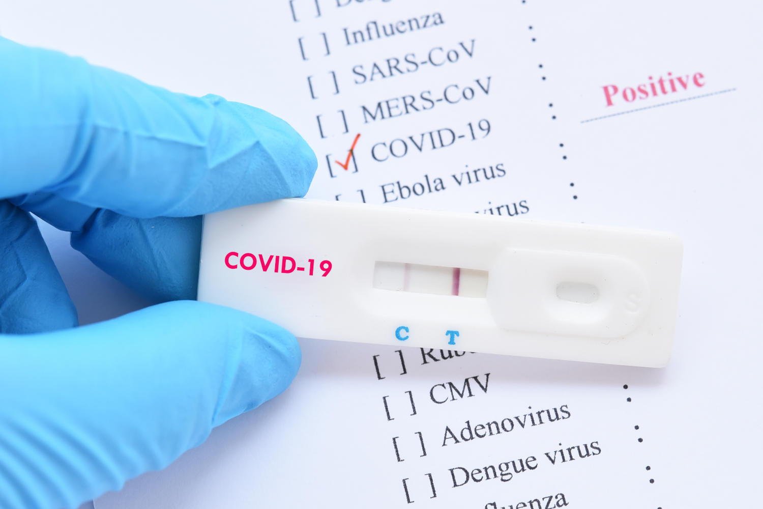 Test COVID positivo con linea C sbiadita