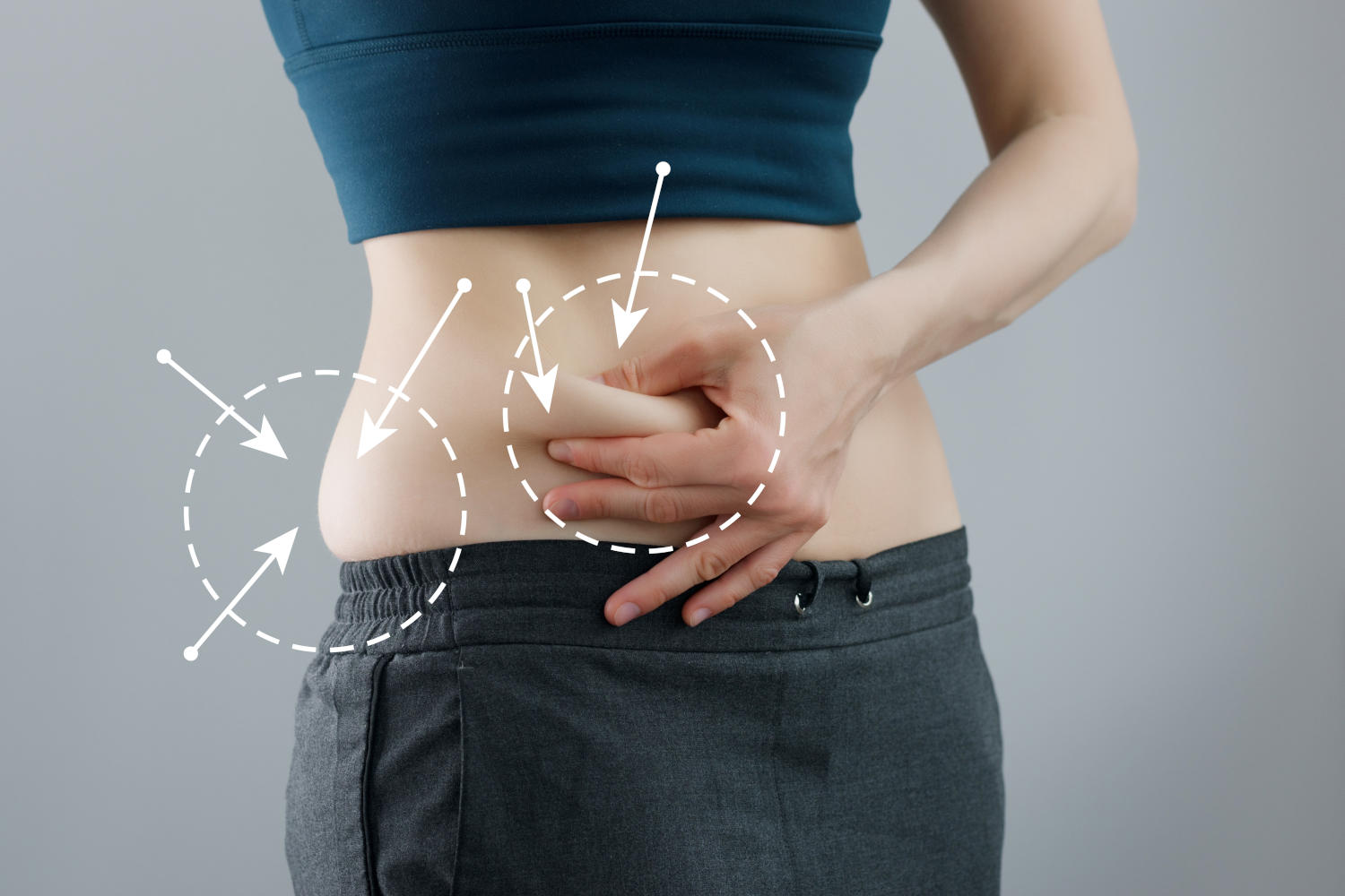 Pancia di una donna skinny fat (falsa magra)