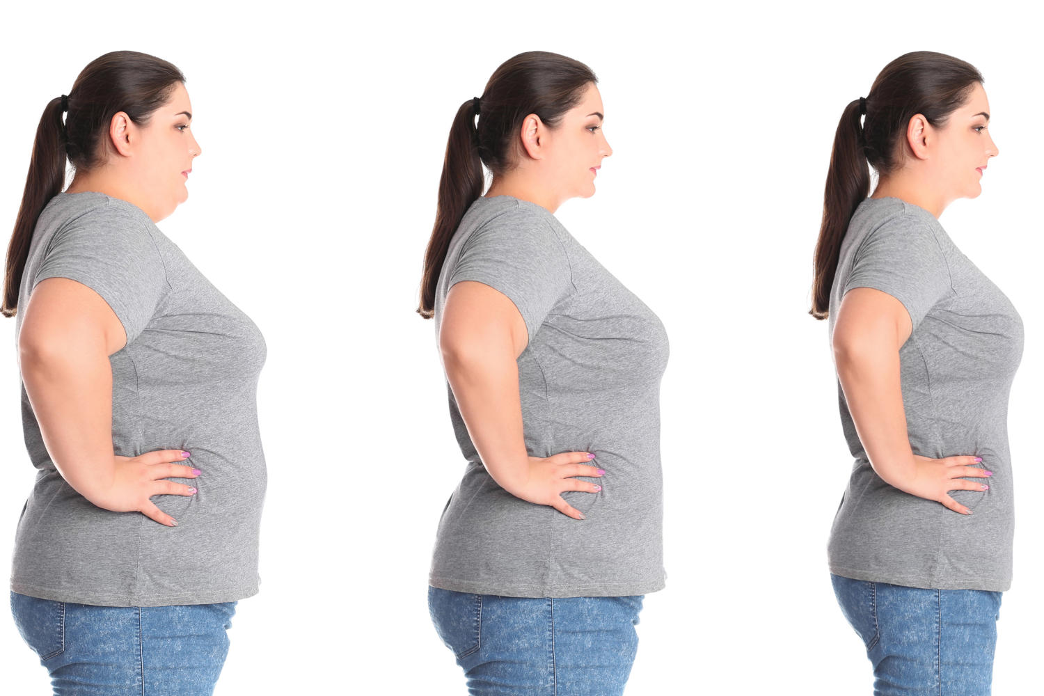 Tre foto successive che dimostrano la perdita di peso di una donna