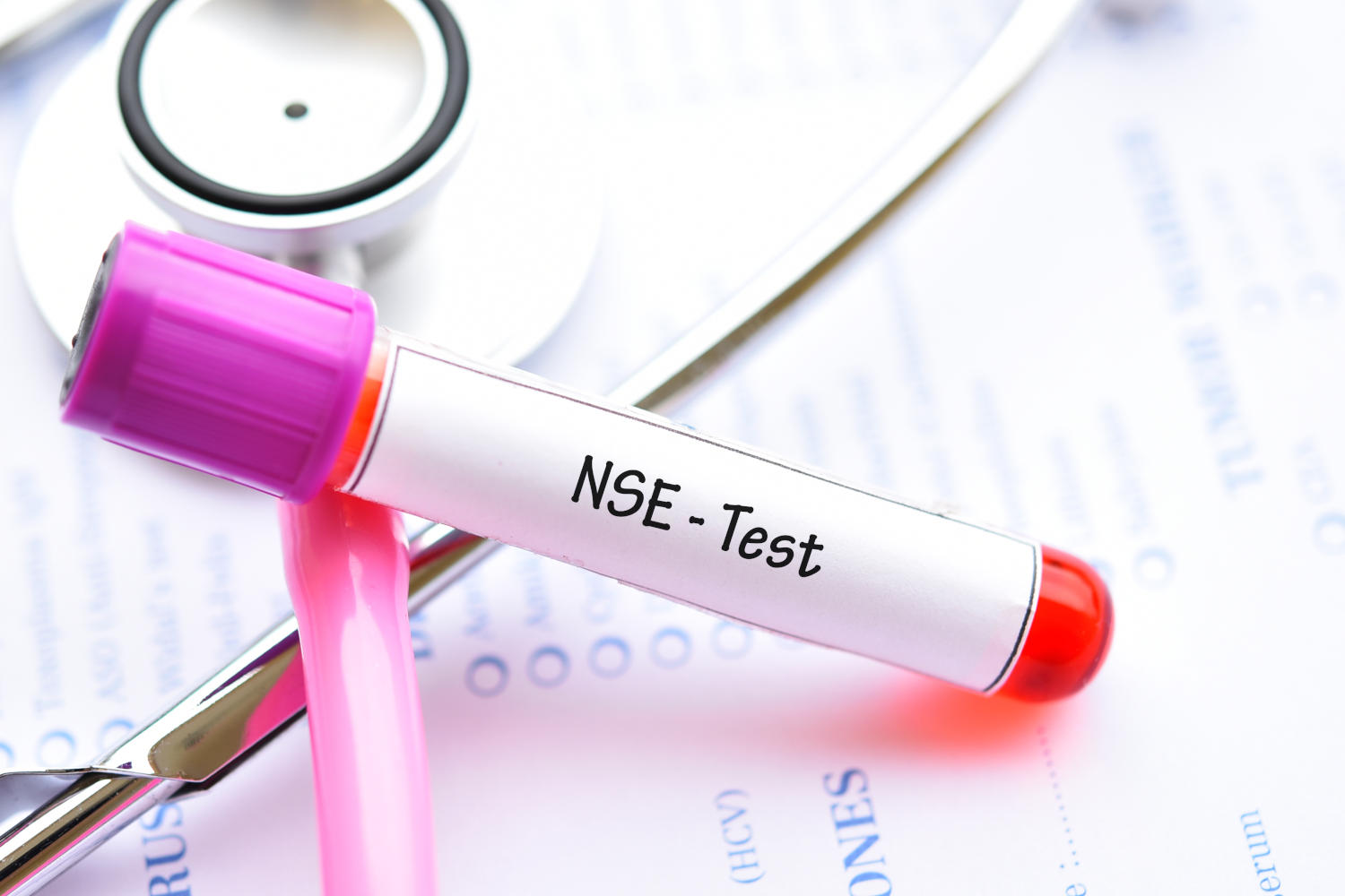 Provetta con la scritta NSE test