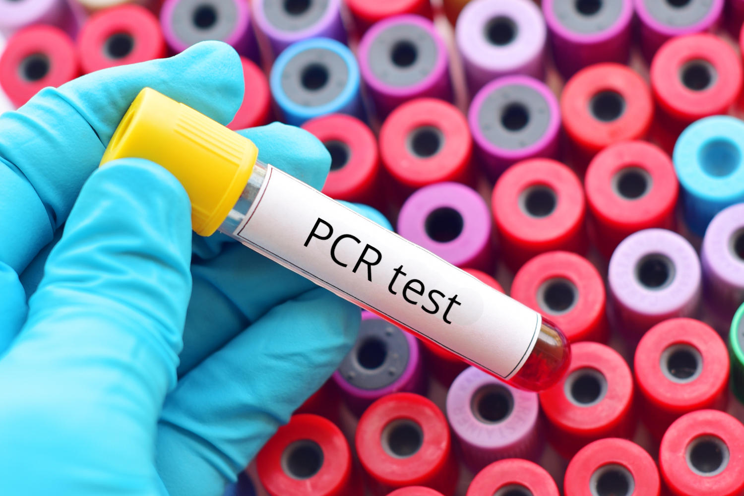 Provetta di sangue con la scritta PCR test