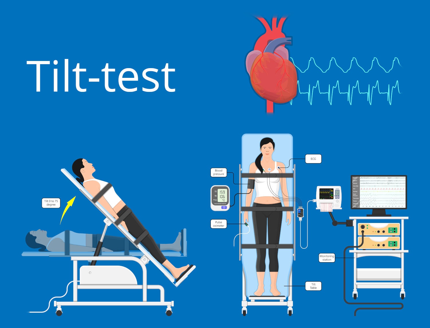 Infografica riassuntiva con la spiegazione del tilt-test