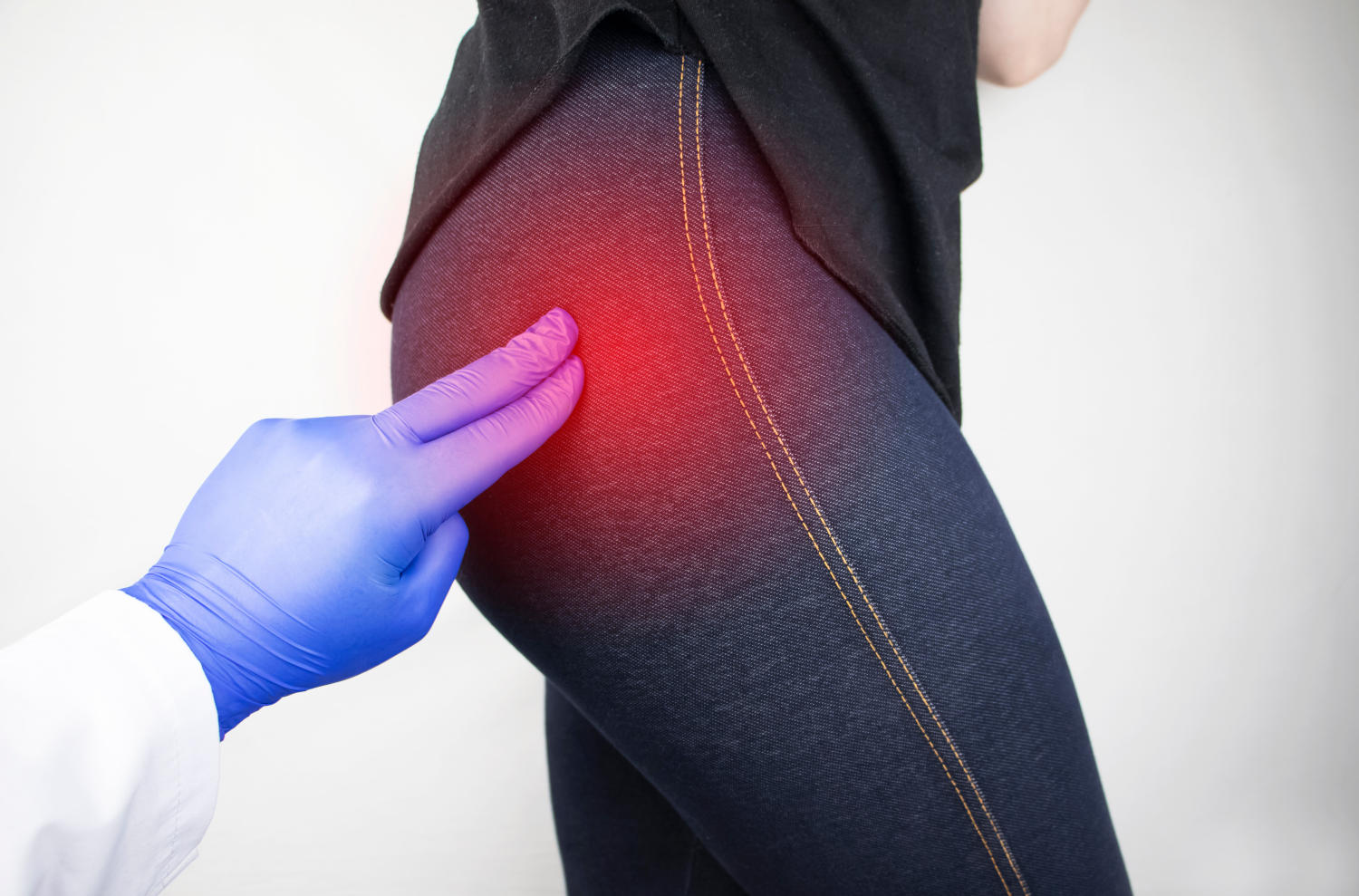 Concetto di dolore al gluteo, con un medico che indica con due dita sul punto di origine