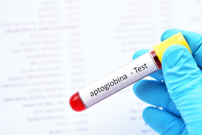 Provetta di sangue con la scritta "aptoglobina - Test"