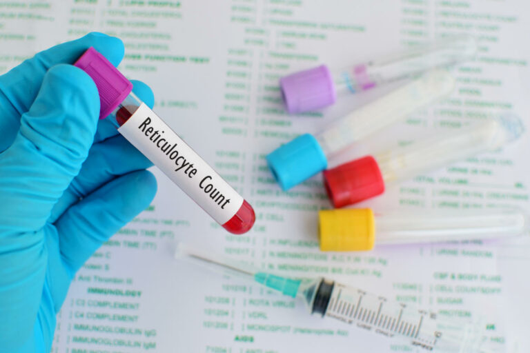 Provetta per l'esame del sangue dei reticolociti