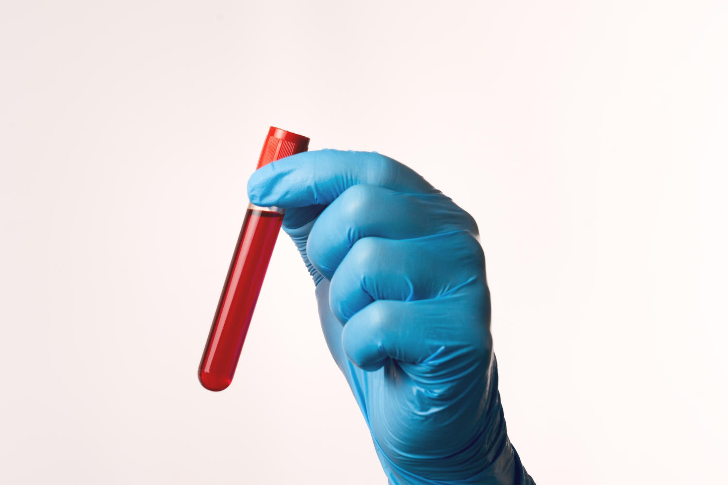 Provetta di sangue