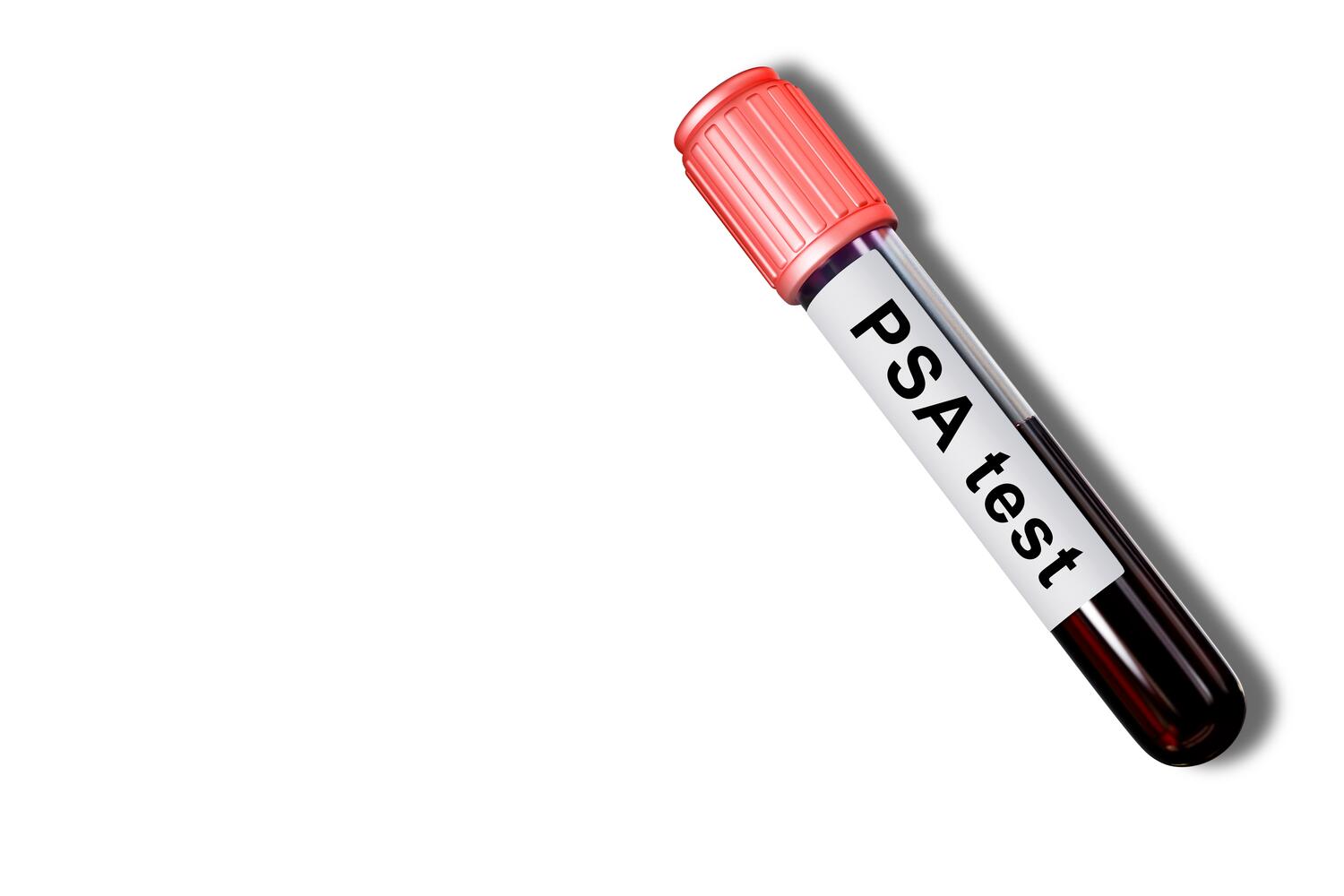 Provetta di sangue con la scritta "PSA test".