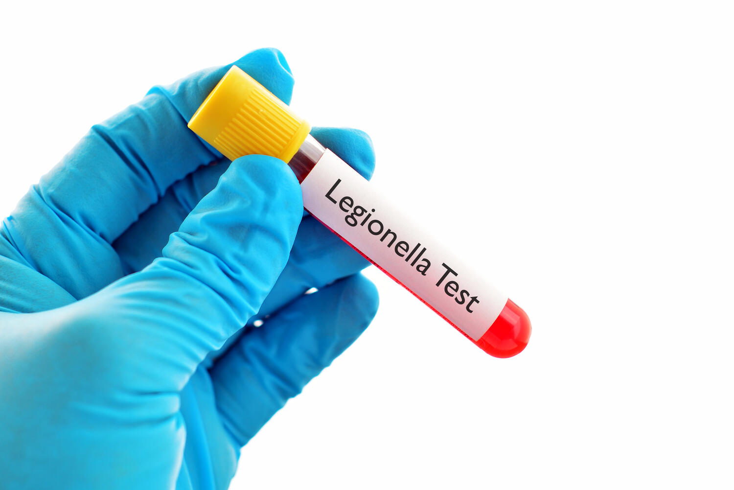 Provetta con la scritta "Legionella"
