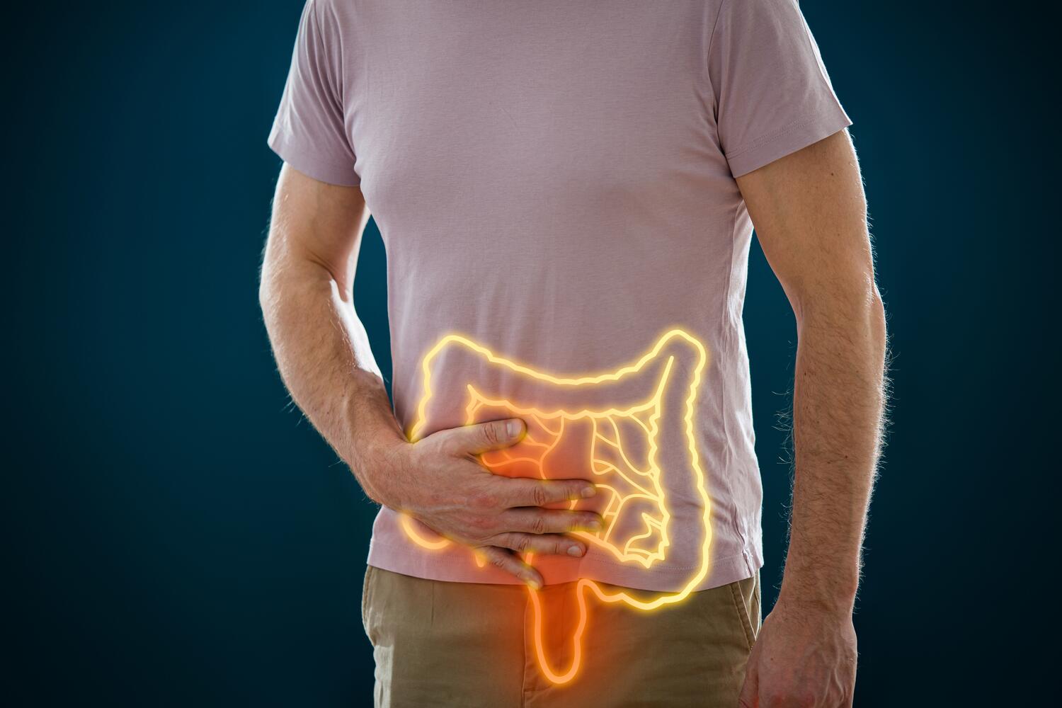Immagine concettuale di un tumore al colon
